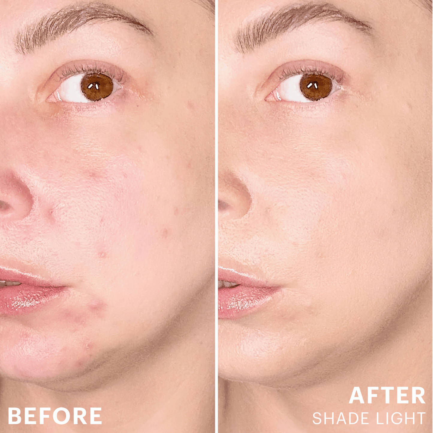 Spot Treat Concealer - Glo Skin Beauty UK&I